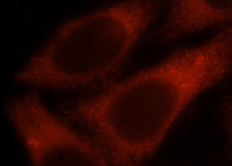 Immunofluorescent analysis of HepG2 cells, using PGM1 antibody Catalog No:113789 at 1:25 dilution and Rhodamine-labeled goat anti-rabbit IgG (red).