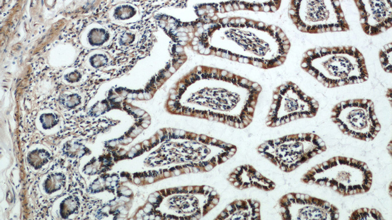 Immunohistochemical of paraffin-embedded human small intestine using Catalog No:115859(TAX1BP3 antibody) at dilution of 1:50 (under 10x lens)