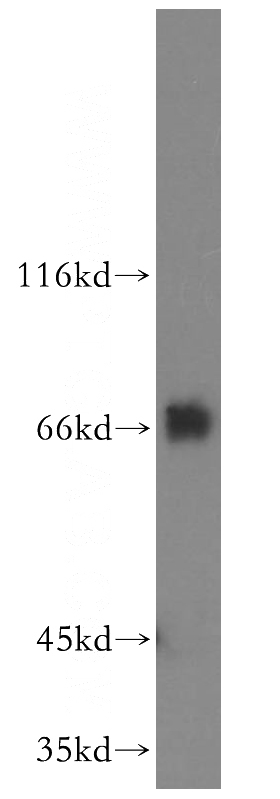 K-562 cells were subjected to SDS PAGE followed by western blot with Catalog No:110666(FIP1L1 antibody) at dilution of 1:300