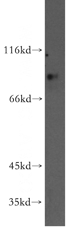 mouse pancreas tissue were subjected to SDS PAGE followed by western blot with Catalog No:114174(PRDM4 antibody) at dilution of 1:500