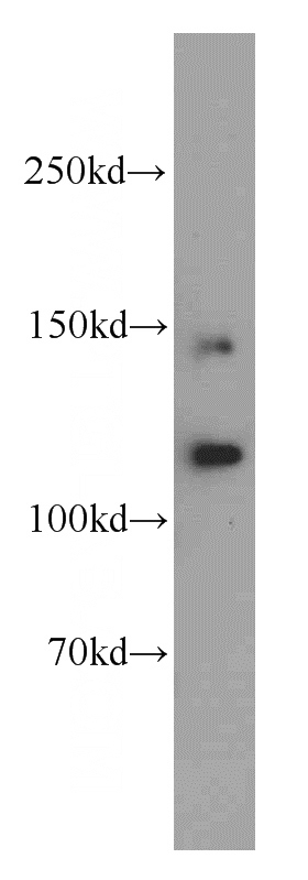 mouse heart tissue were subjected to SDS PAGE followed by western blot with Catalog No:113962(PLEKHG5 antibody) at dilution of 1:500