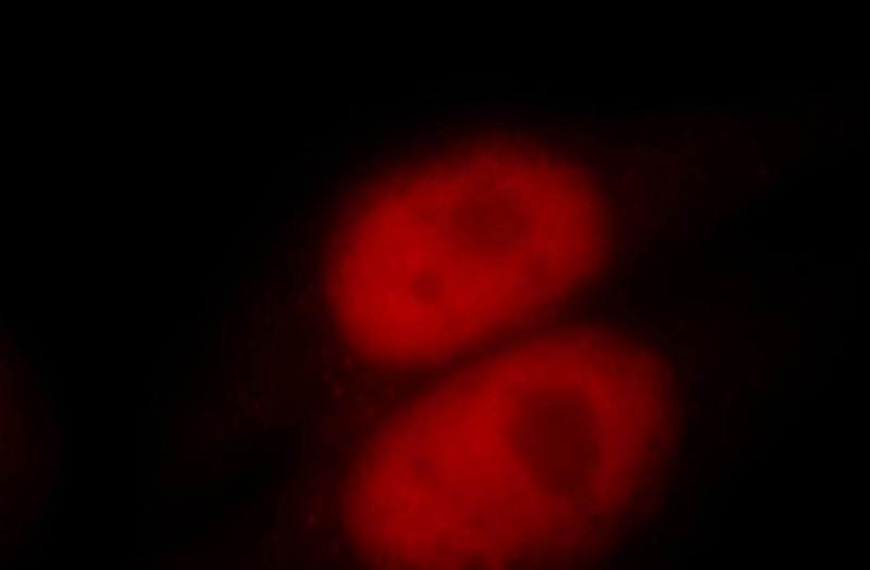 Immunofluorescent analysis of Hela cells, using MSH6 antibody Catalog No:112869 at 1:25 dilution and Rhodamine-labeled goat anti-rabbit IgG (red).