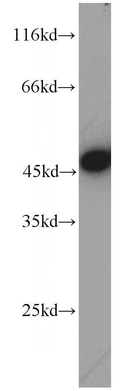 Jurkat cells were subjected to SDS PAGE followed by western blot with Catalog No:112456(MAGT1 antibody) at dilution of 1:1000