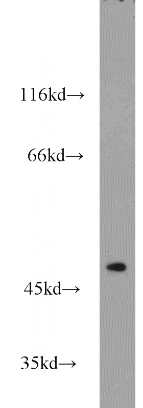 mouse skeletal muscle tissue were subjected to SDS PAGE followed by western blot with Catalog No:107896(ADSS antibody) at dilution of 1:1000