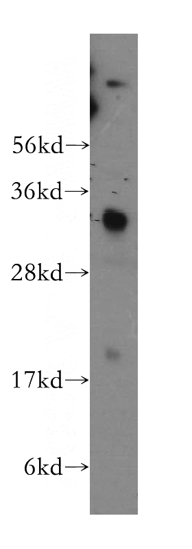human heart tissue were subjected to SDS PAGE followed by western blot with Catalog No:114077(PPA1 antibody) at dilution of 1:500