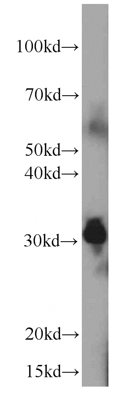 human kidney tissue were subjected to SDS PAGE followed by western blot with Catalog No:107635(TPSAB1 Antibody) at dilution of 1:1000