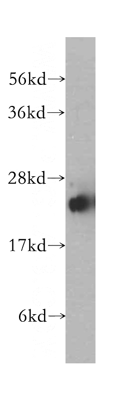 human brain tissue were subjected to SDS PAGE followed by western blot with Catalog No:115728(STMN4 antibody) at dilution of 1:1000