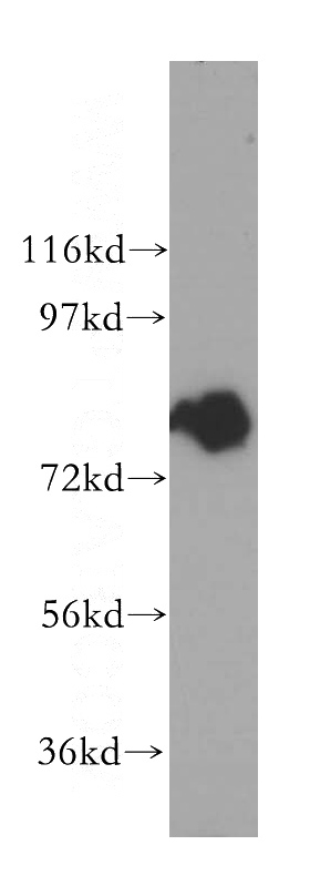 mouse spleen tissue were subjected to SDS PAGE followed by western blot with Catalog No:111808(INPP5B antibody) at dilution of 1:200