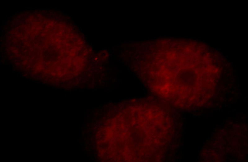 Immunofluorescent analysis of Hela cells, using NCOA5 antibody Catalog No:113043 at 1:25 dilution and Rhodamine-labeled goat anti-rabbit IgG (red).