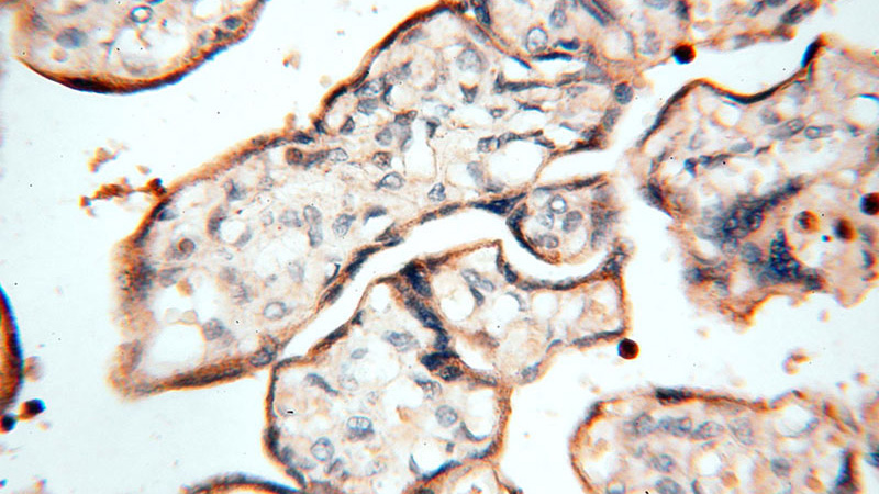 Immunohistochemical of paraffin-embedded human placenta using Catalog No:112464(MAN1A2 antibody) at dilution of 1:50 (under 40x lens)
