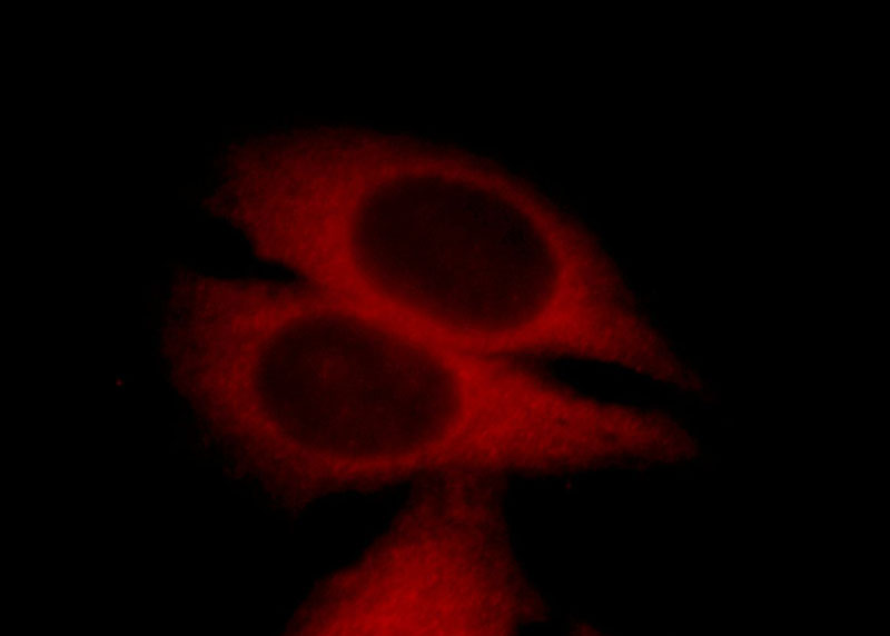 Immunofluorescent analysis of HepG2 cells, using DYNLT3 antibody Catalog No:110143 at 1:25 dilution and Rhodamine-labeled goat anti-rabbit IgG (red).