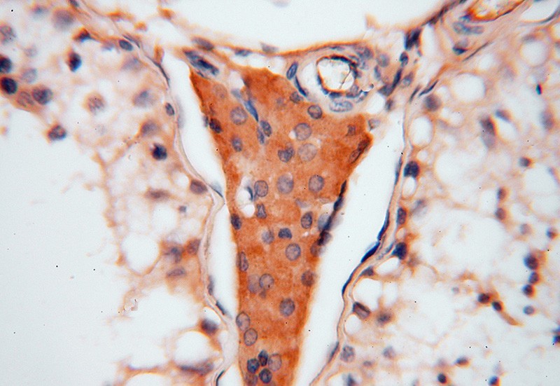 Immunohistochemical of paraffin-embedded human testis using Catalog No:108309(ATP6V1C2 antibody) at dilution of 1:50 (under 40x lens)