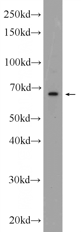 mouse lung tissue were subjected to SDS PAGE followed by western blot with Catalog No:108694(C20orf152 Antibody) at dilution of 1:300