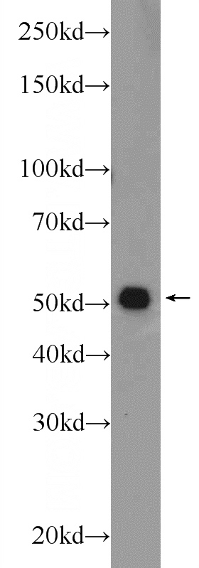MCF-7 cells were subjected to SDS PAGE followed by western blot with Catalog No:116112(TMEM194A Antibody) at dilution of 1:1000