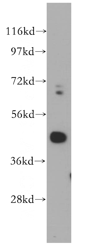 HeLa cells were subjected to SDS PAGE followed by western blot with Catalog No:114394(PSMD11 antibody) at dilution of 1:500