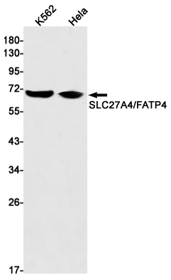 Western blot detection of SLC27A4/FATP4 in K562,Hela cell lysates using SLC27A4/FATP4 Rabbit mAb(1:1000 diluted).Predicted band size:72kDa.Observed band size:72kDa.
