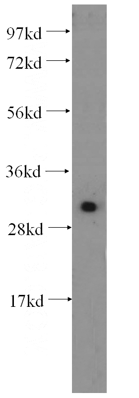 HeLa cells were subjected to SDS PAGE followed by western blot with Catalog No:111905(KLK8 antibody) at dilution of 1:500