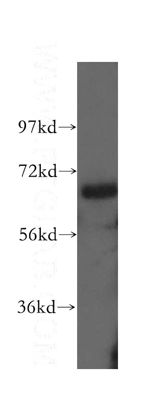 mouse brain tissue were subjected to SDS PAGE followed by western blot with Catalog No:107678(AATF antibody) at dilution of 1:800