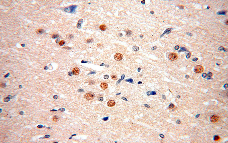 Immunohistochemical of paraffin-embedded human brain using Catalog No:110575(FAM160B2 antibody) at dilution of 1:100 (under 40x lens)