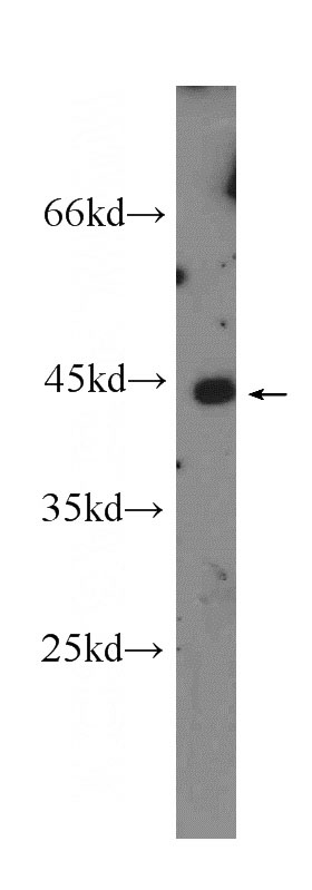 A375 cells were subjected to SDS PAGE followed by western blot with Catalog No:110723(FLOT2 antibody) at dilution of 1:300