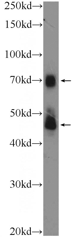 MKN-45 cells were subjected to SDS PAGE followed by western blot with Catalog No:116319(TRIM5 Antibody) at dilution of 1:300