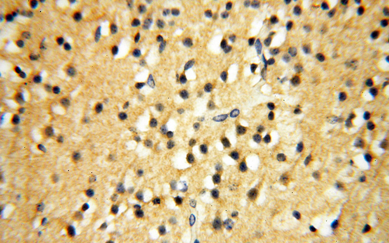 Immunohistochemical of paraffin-embedded human brain using Catalog No:110925(GDI1 antibody) at dilution of 1:50 (under 40x lens)