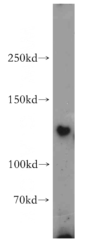 HEK-293 cells were subjected to SDS PAGE followed by western blot with Catalog No:110465(FAM120A antibody) at dilution of 1:500