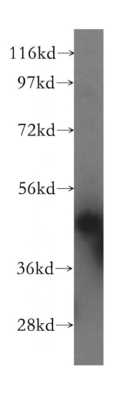 HeLa cells were subjected to SDS PAGE followed by western blot with Catalog No:112854(MRPS27 antibody) at dilution of 1:500