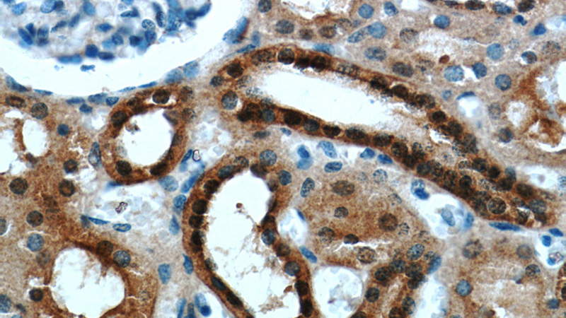 Immunohistochemical of paraffin-embedded human kidney using Catalog No:111385(HDDC3 antibody) at dilution of 1:100 (under 40x lens)