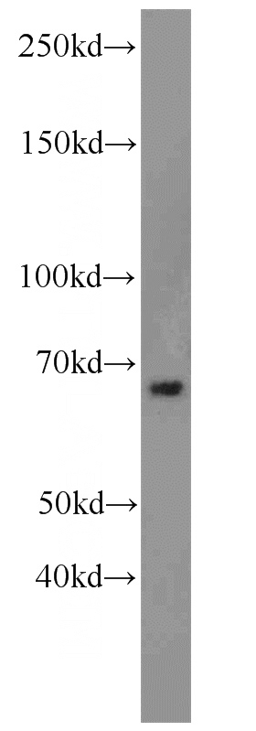 mouse liver tissue were subjected to SDS PAGE followed by western blot with Catalog No:112334(LRRC47 antibody) at dilution of 1:1000