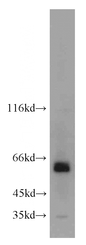 HeLa cells were subjected to SDS PAGE followed by western blot with Catalog No:107731(ACBD5 antibody) at dilution of 1:500