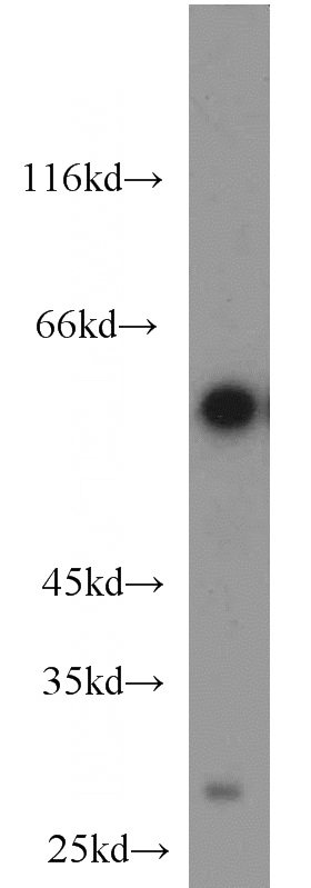HL-60 cells were subjected to SDS PAGE followed by western blot with Catalog No:115379(SLC45A2 antibody) at dilution of 1:1000