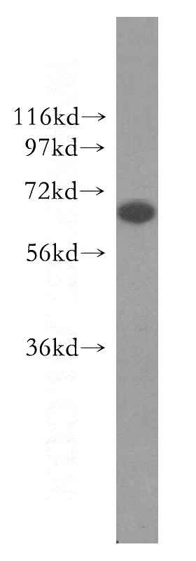 human liver tissue were subjected to SDS PAGE followed by western blot with Catalog No:115338(SLC25A6 antibody) at dilution of 1:500