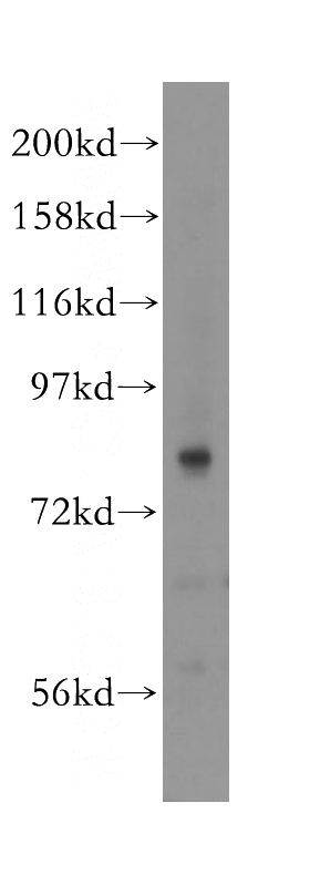 human lung tissue were subjected to SDS PAGE followed by western blot with Catalog No:114184(PREP antibody) at dilution of 1:400