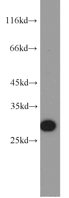 HEK-293 cells were subjected to SDS PAGE followed by western blot with Catalog No:112952(NARFL-Specific antibody) at dilution of 1:800