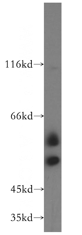 human testis tissue were subjected to SDS PAGE followed by western blot with Catalog No:115918(TCP11 antibody) at dilution of 1:3000