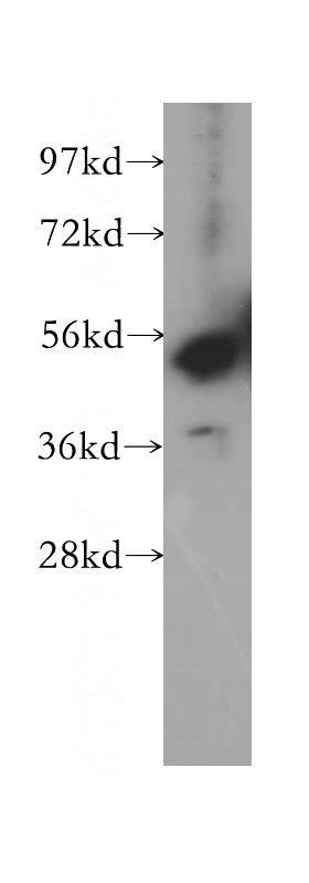 human brain tissue were subjected to SDS PAGE followed by western blot with Catalog No:113756(PCTK3 antibody) at dilution of 1:500