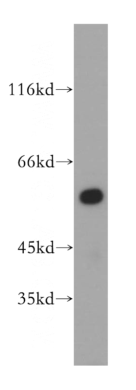 A431 cells were subjected to SDS PAGE followed by western blot with Catalog No:111485(HMGCS1 antibody) at dilution of 1:500