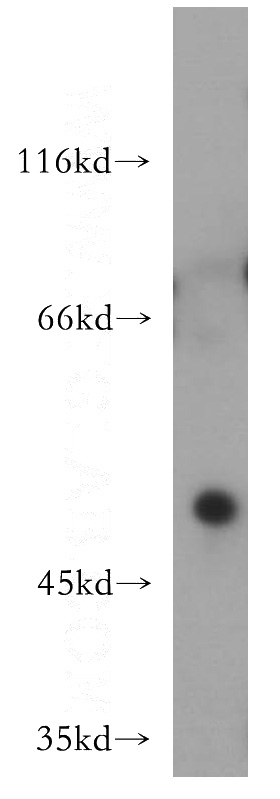 mouse heart tissue were subjected to SDS PAGE followed by western blot with Catalog No:111535(HOXC10 antibody) at dilution of 1:500
