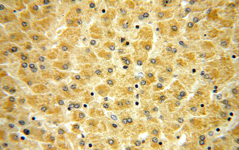 Immunohistochemical of paraffin-embedded human liver using Catalog No:114876(RPL21 antibody) at dilution of 1:100 (under 40x lens)