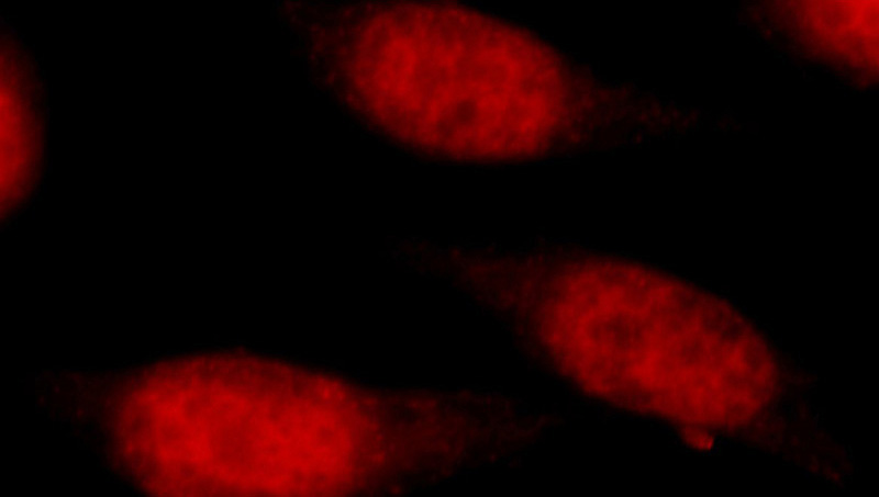 Immunofluorescent analysis of MCF-7 cells, using TBP antibody Catalog No:115878 at 1:50 dilution and Rhodamine-labeled goat anti-rabbit IgG (red).