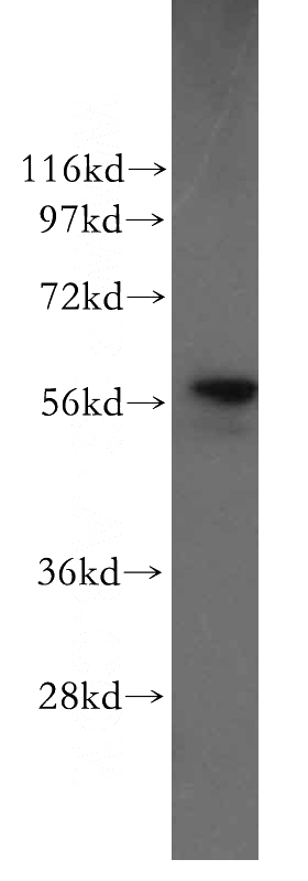 COLO 320 cells were subjected to SDS PAGE followed by western blot with Catalog No:113681(PDIA1 antibody) at dilution of 1:500