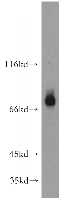 L02 cells were subjected to SDS PAGE followed by western blot with Catalog No:111247(GTSE1 antibody) at dilution of 1:300