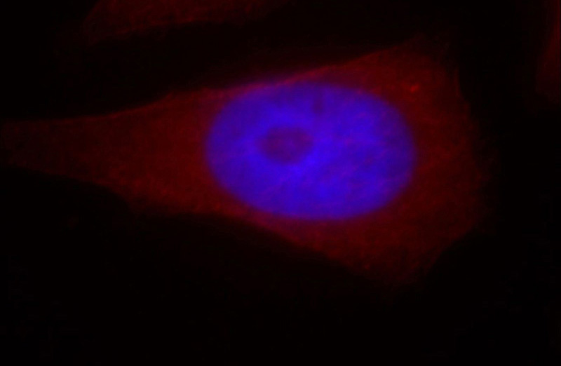 Immunofluorescent analysis of Hela cells, using MPRIP antibody Catalog No:112756 at 1:25 dilution and Rhodamine-labeled goat anti-rabbit IgG (red). Blue pseudocolor = DAPI (fluorescent DNA dye).