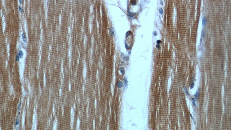 Immunohistochemical of paraffin-embedded human skeletal muscle using Catalog No:108917(CAMK2B antibody) at dilution of 1:50 (under 40x lens)