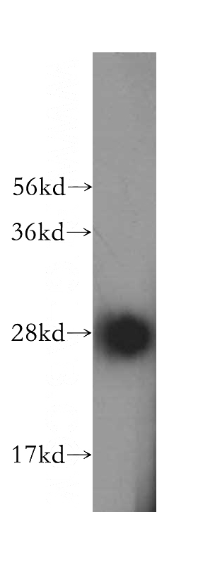 HepG2 cells were subjected to SDS PAGE followed by western blot with Catalog No:115641(SPR antibody) at dilution of 1:500