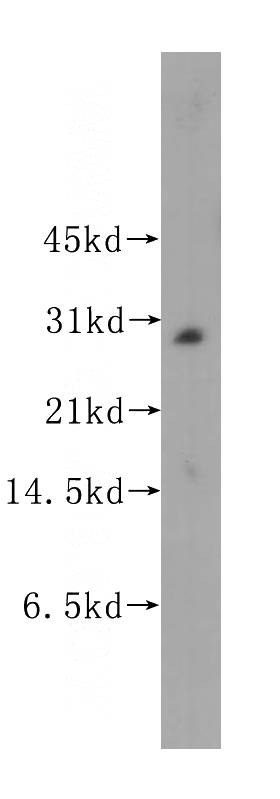 human brain tissue were subjected to SDS PAGE followed by western blot with Catalog No:112675(MLF2 antibody) at dilution of 1:400