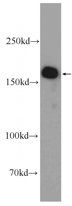 Jurkat cells were subjected to SDS PAGE followed by western blot with Catalog No:110970(GIGYF2 Antibody) at dilution of 1:1000