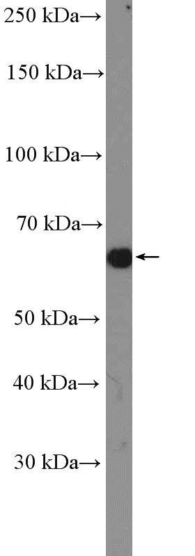 HeLa cells were subjected to SDS PAGE followed by western blot with Catalog No:113631(PDLIM5 Antibody) at dilution of 1:1000