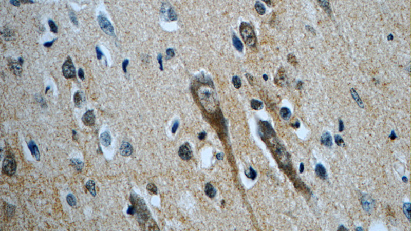 Immunohistochemistry of paraffin-embedded human brain slide using Catalog No:109302(SLC5A7 Antibody) at dilution of 1:50